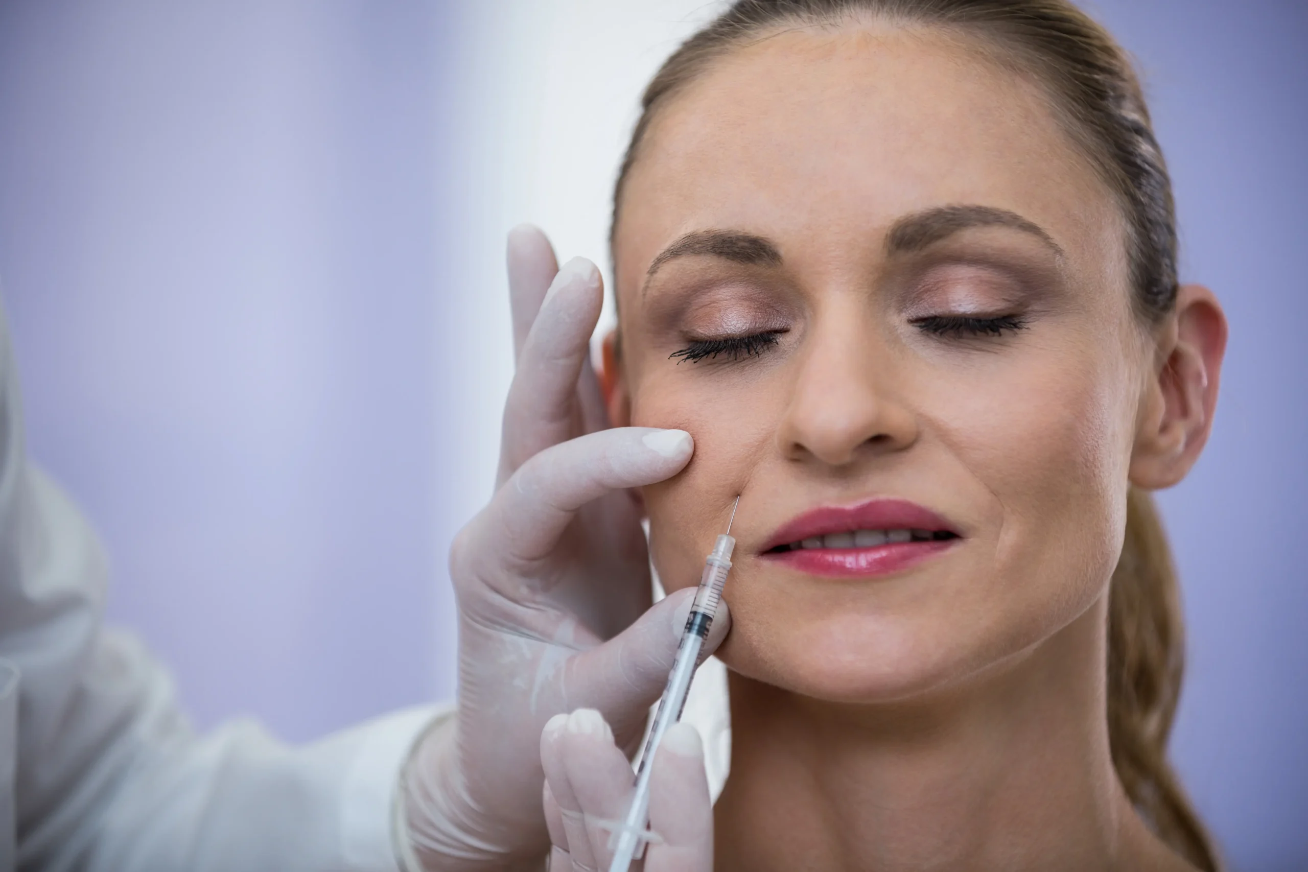 radiesse dermal filler treatment in dubai